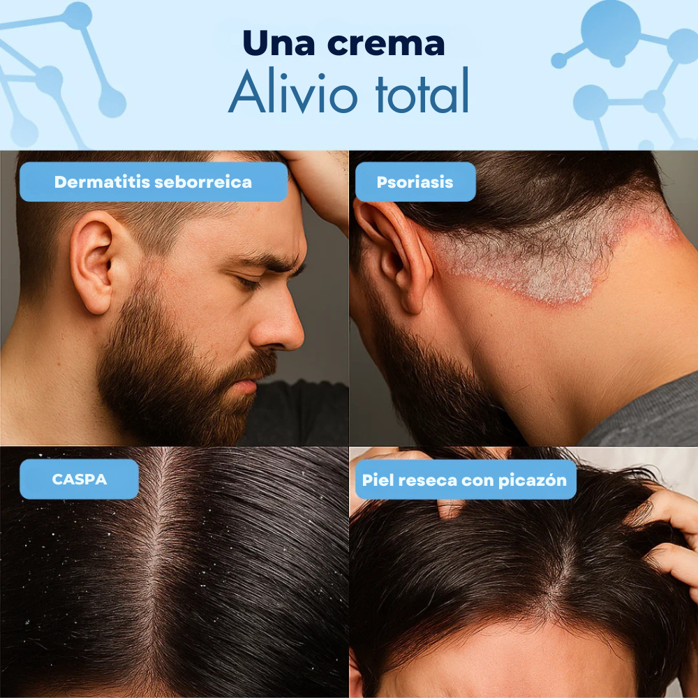 Crownix™ Crema antifúngica