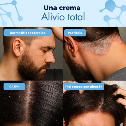Crownix™ Crema antifúngica