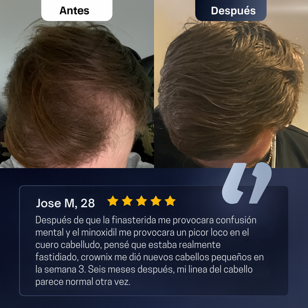 Roll-On de Crecimiento Capilar™